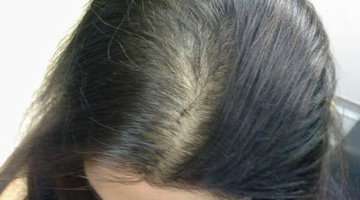 Шампунь Против преждевременного выпадения