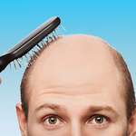Алопеция: правда и мифы о лечении